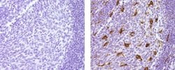 Mouse IgG1 kappa Isotype Control (P3.6.2.8.1), eBioscience , Invitrogen