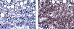 Mouse IgG1 kappa Isotype Control (P3.6.2.8.1), eBioscience , Invitrogen