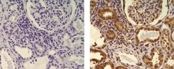 Mouse IgG1 kappa Isotype Control (P3.6.2.8.1), eBioscience , Invitrogen