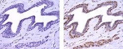 Mouse IgG1 kappa Isotype Control (P3.6.2.8.1), eBioscience , Invitrogen