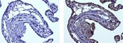 Mouse IgG1 kappa Isotype Control (P3.6.2.8.1), eBioscience , Invitrogen