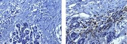 Mouse IgG1 kappa Isotype Control (P3.6.2.8.1), eBioscience , Invitrogen