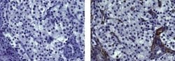 Mouse IgG1 kappa Isotype Control (P3.6.2.8.1), eBioscience , Invitrogen