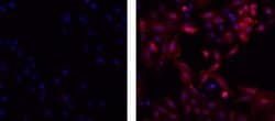 Mouse IgG2b kappa Isotype Control (eBMG2b), eBioscience , Invitrogen:Antibodies:Isotype