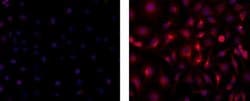 Mouse IgG2b kappa Isotype Control (eBMG2b), eBioscience , Invitrogen:Antibodies:Isotype