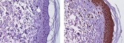 Mouse IgG2b kappa Isotype Control (eBMG2b), eBioscience , Invitrogen:Antibodies:Isotype