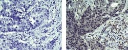 Mouse IgG2b kappa Isotype Control (eBMG2b), eBioscience , Invitrogen:Antibodies:Isotype