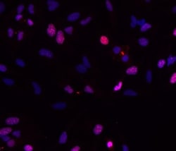 Invitrogen Survivin Monoclonal Antibody (STLALYV), eBioscience , Invitrogen