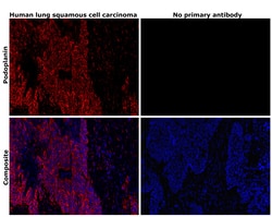 Invitrogen Podoplanin Monoclonal Antibody (NZ-1.3), eBioscience , Invitrogen