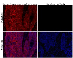 Invitrogen Podoplanin Monoclonal Antibody (NZ-1.3), eBioscience , Invitrogen