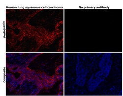 Invitrogen Podoplanin Monoclonal Antibody (NZ-1.3), eBioscience , Invitrogen