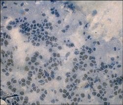 Invitrogen HCN2 Monoclonal Antibody (QQA 4A6), eBioscience 100 &mu;g; Unconjugated:Antibodies,