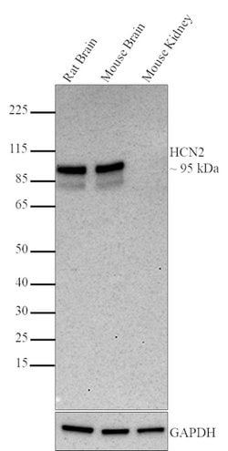 Invitrogen HCN2 Monoclonal Antibody (QQA 4A6), eBioscience 100 &mu;g; Unconjugated:Antibodies,