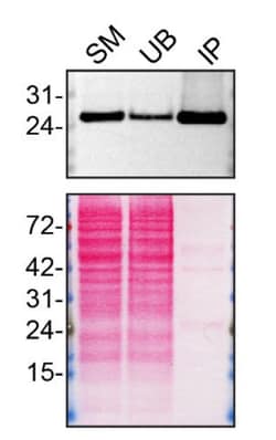 Invitrogen RAB5A Monoclonal Antibody (2E8B11), eBioscience 100 &mu;g; Unconjugated:Antibodies,