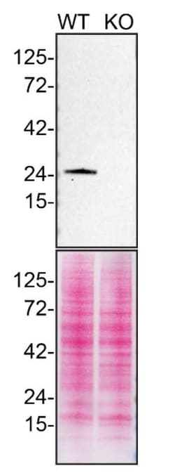 Invitrogen RAB5A Monoclonal Antibody (2E8B11), eBioscience 100 &mu;g; Unconjugated:Antibodies,