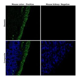 Invitrogen Desmin Monoclonal Antibody (DE-U-10), eBioscience 2 mg; Unconjugated:Antibodies,