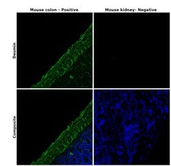 Invitrogen Desmin Monoclonal Antibody (DE-U-10), eBioscience 2 mg; Unconjugated:Antibodies,