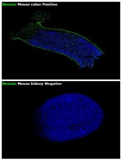 Invitrogen Desmin Monoclonal Antibody (DE-U-10), eBioscience 2 mg; Unconjugated:Antibodies,