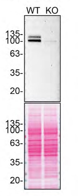 APP (Amyloid Precursor Protein) Monoclonal Antibody (22C11), eBioscience