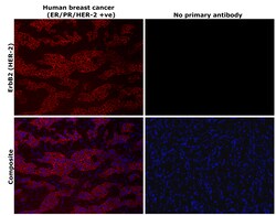 Invitrogen ErbB2 (HER-2) Monoclonal Antibody (MJD2), eBioscience , Invitrogen