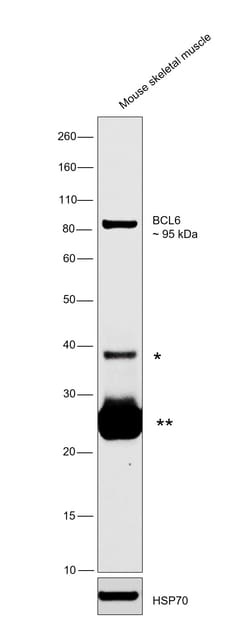 Invitrogen BCL6 Monoclonal Antibody (GI191E), eBioscience , Invitrogen