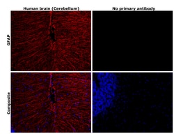 Invitrogen GFAP Monoclonal Antibody (GA5), eBioscience , Invitrogen 2 mg;