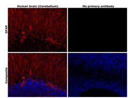Invitrogen GFAP Monoclonal Antibody (GA5), eBioscience , Invitrogen 2 mg;