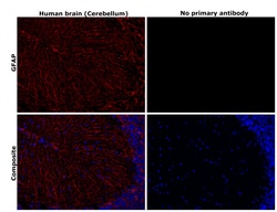Invitrogen GFAP Monoclonal Antibody (GA5), eBioscience , Invitrogen 2 mg;