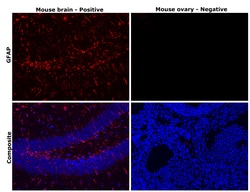 Invitrogen GFAP Monoclonal Antibody (GA5), eBioscience , Invitrogen 2 mg;