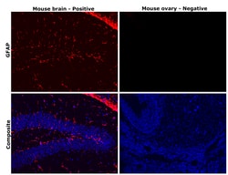 Invitrogen GFAP Monoclonal Antibody (GA5), eBioscience , Invitrogen 2 mg;
