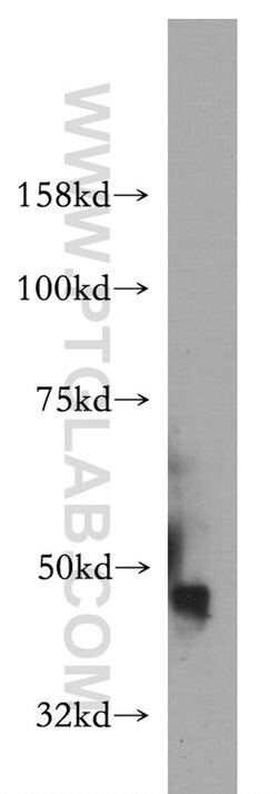IGSF11 Rabbit anti-Human, Mouse, Rat, Polyclonal, Proteintech 150 &mu;L;