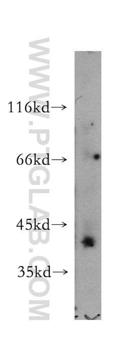 IGSF11 Rabbit anti-Human, Mouse, Rat, Polyclonal, Proteintech 150 &mu;L;