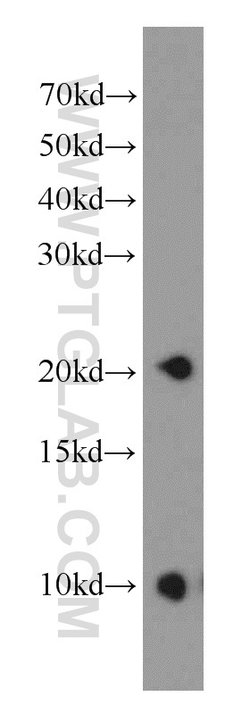 PPP3R2 Rabbit anti-Human, Mouse, Polyclonal, Proteintech 150 &mu;L; Unconjugated:Antibodies,