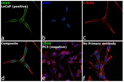 CD10 Monoclonal Antibody (eBioCB-CALLA (CB-CALLA)), eBioscience:Antibodies,