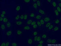 STAG1 Rabbit anti-Human, Mouse, Rat, Polyclonal, Proteintech:Antibodies:Primary