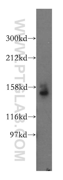 STAG1 Rabbit anti-Human, Mouse, Rat, Polyclonal, Proteintech:Antibodies:Primary