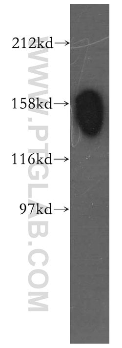 STAG1 Rabbit anti-Human, Mouse, Rat, Polyclonal, Proteintech:Antibodies:Primary