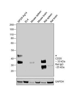 CD20 Monoclonal Antibody (AISB12), eBioscience , Invitrogen:Antibodies:Primary