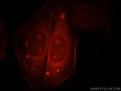 PSMA8 Rabbit anti-Human, Mouse, Rat, Polyclonal, Proteintech 150 &mu;L;