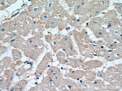 SOCS3 Rabbit anti-Human, Mouse, Polyclonal, Proteintech 150 &mu;L; Unconjugated:Antibodies,