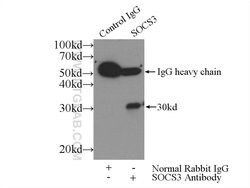 SOCS3 Rabbit anti-Human, Mouse, Polyclonal, Proteintech 150 &mu;L; Unconjugated:Antibodies,