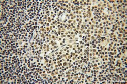ROD1 Rabbit anti-Human, Mouse, Rat, Polyclonal, Proteintech 150 &mu;L;