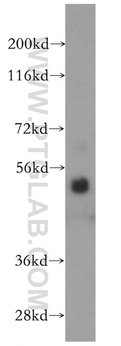 ROD1 Rabbit anti-Human, Mouse, Rat, Polyclonal, Proteintech 150 &mu;L;