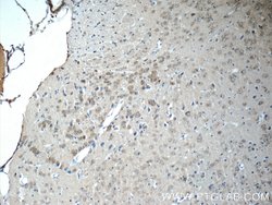 SCRG1 Rabbit anti-Human, Mouse, Rat, Polyclonal, Proteintech:Antibodies:Primary