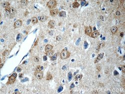 SCRG1 Rabbit anti-Human, Mouse, Rat, Polyclonal, Proteintech:Antibodies:Primary