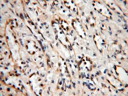 ABHD2 Rabbit anti-Human, Mouse, Rat, Polyclonal, Proteintech:Antibodies:Primary