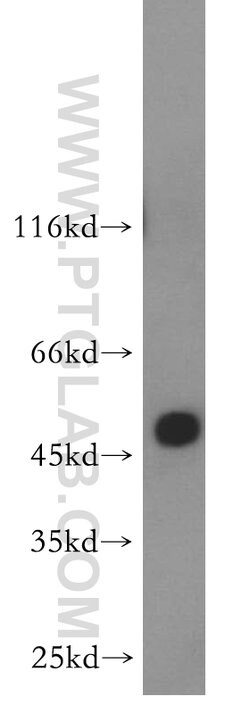 ABHD2 Rabbit anti-Human, Mouse, Rat, Polyclonal, Proteintech:Antibodies:Primary