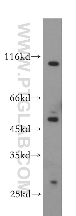 ABHD2 Rabbit anti-Human, Mouse, Rat, Polyclonal, Proteintech:Antibodies:Primary