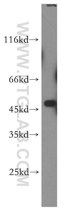 ABHD2 Rabbit anti-Human, Mouse, Rat, Polyclonal, Proteintech:Antibodies:Primary