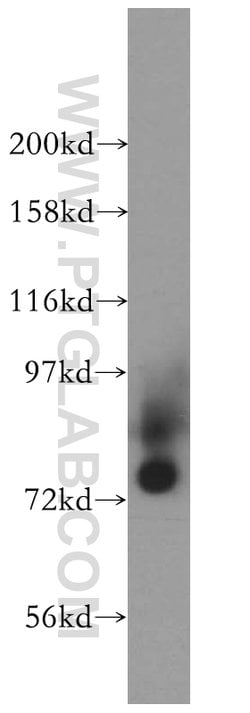 HLCS Rabbit anti-Human, Mouse, Rat, Polyclonal, Proteintech 150 &mu;L;